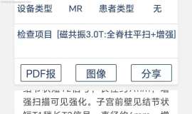 肺癌术后五年，脑膜转移治疗三年，伏美替尼6粒，脊膜转移，脑萎缩