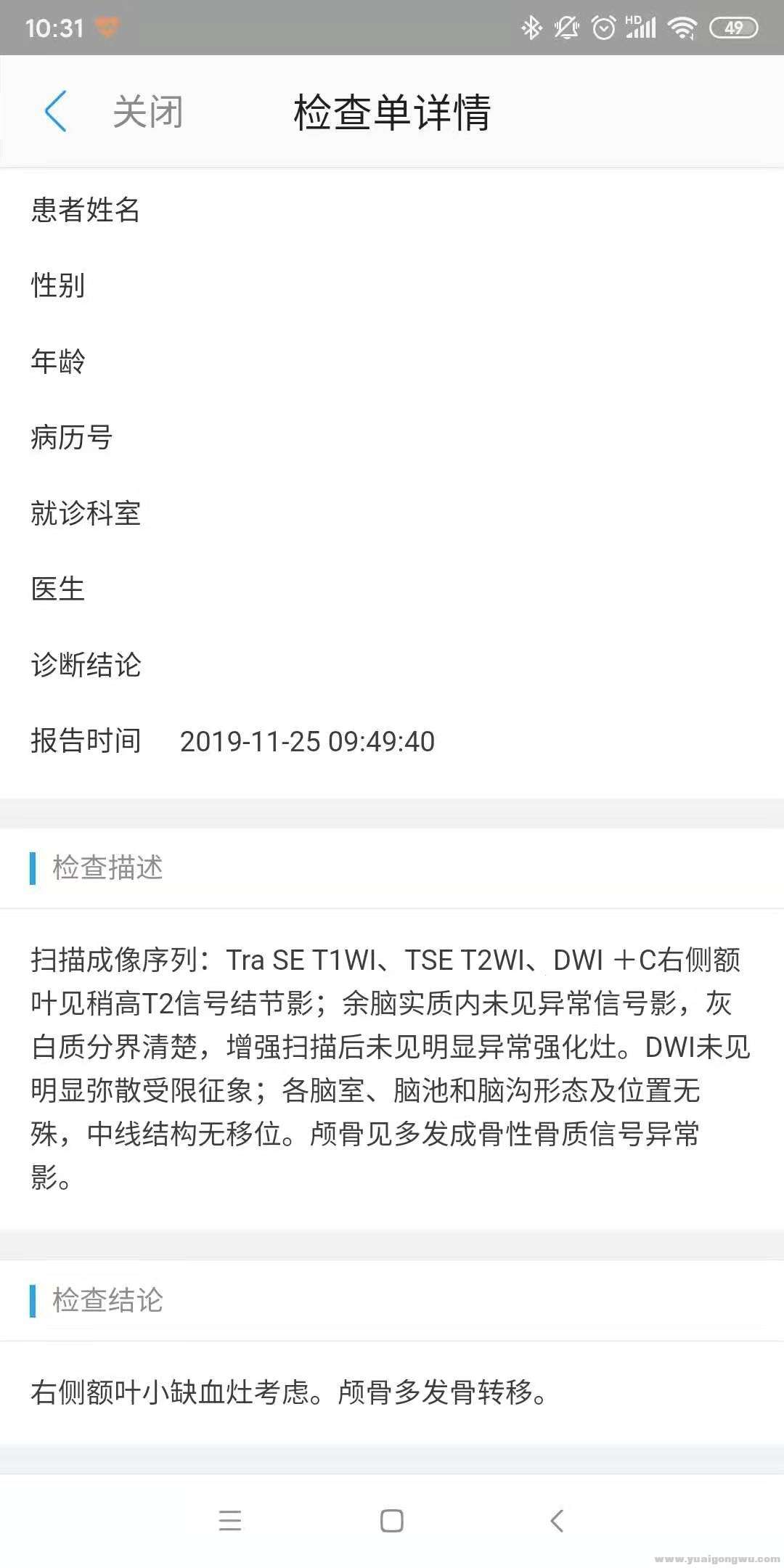 2019-11 脑核磁.jpg