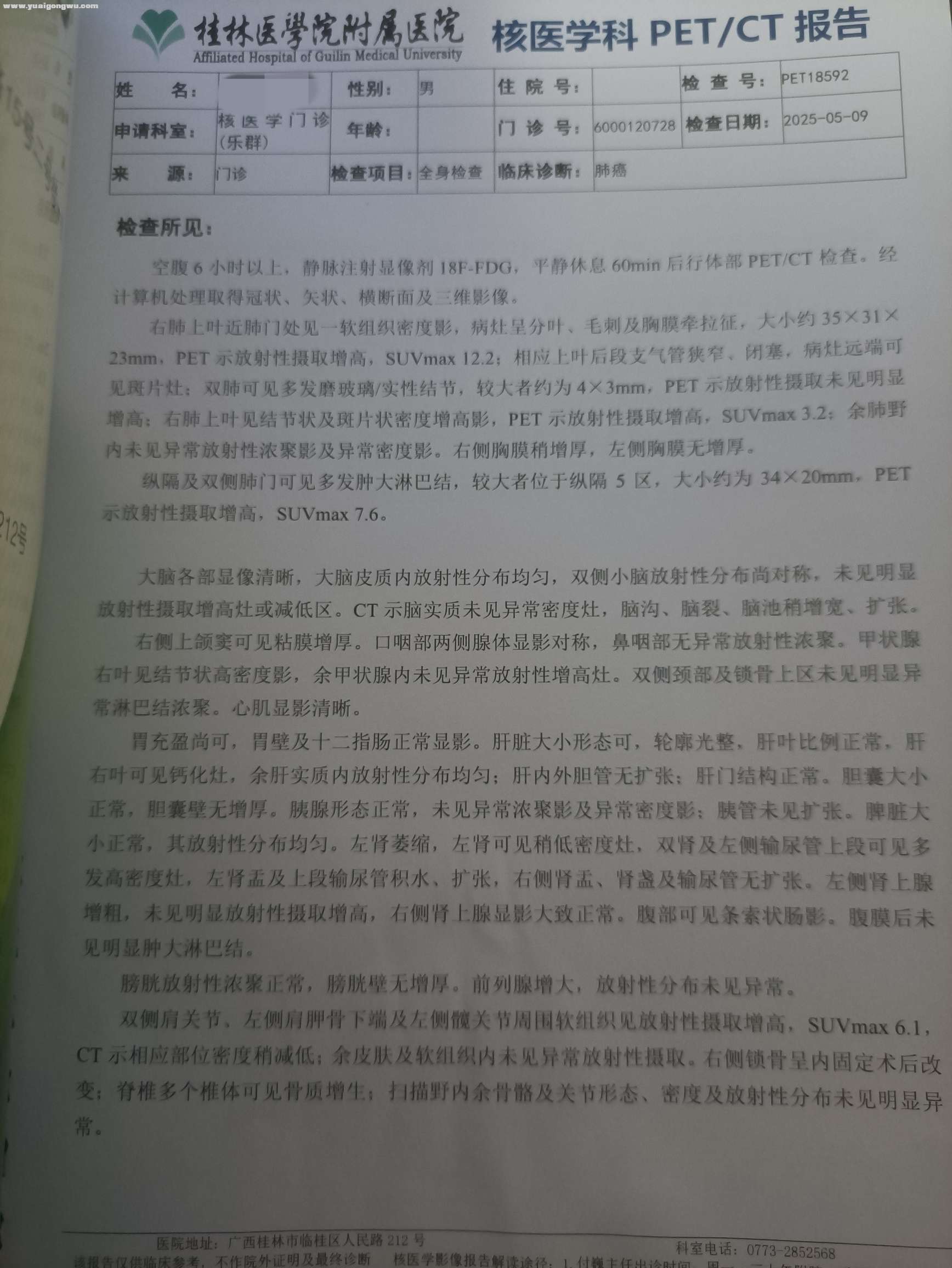 请教一下 肺腺癌IIIC期，基因检测无靶点，有PD-L1表达 后续情况应该怎么治